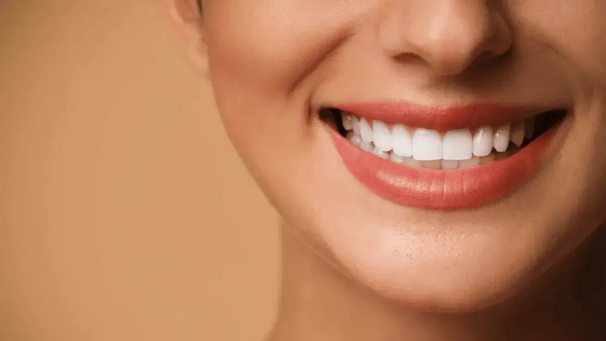 Dental Veneers