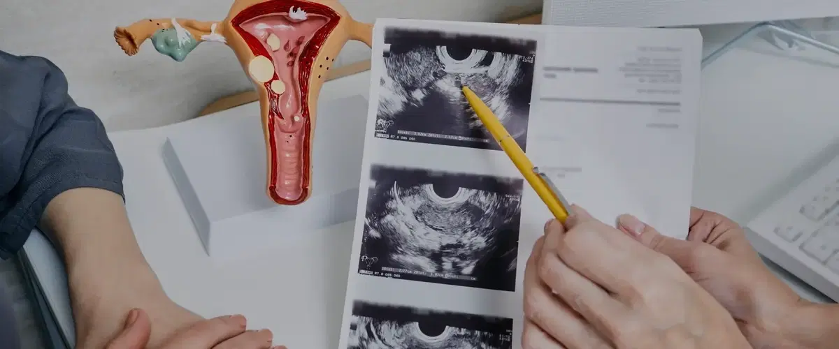 Gynecologic Oncology