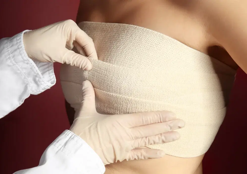 Mastectomy