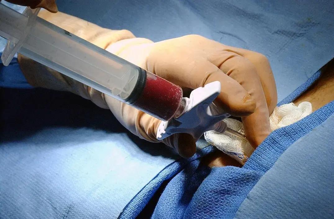 one Marrow Transplant